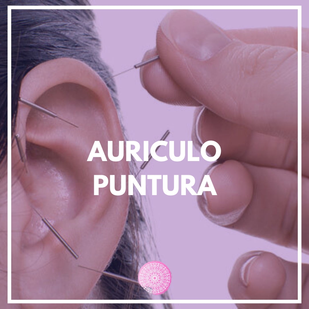 auriculopuntura
